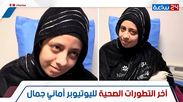 كانت هتروح فيها.أول ظهور لليوتيوبرز أماني جمال بعد اللي حصلها:إزاي خست كدا؟ وهل الحسد سبب اللي حصلها
