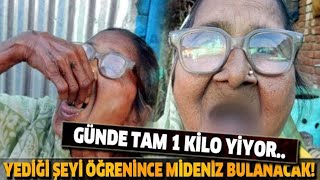 Yediği Şeyi ÖĞRENİNCE Mideniz BULANACAK