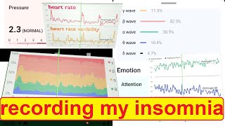 :-/ Kickstarter Flowtime EEG + heart rate: recording my insomnia
