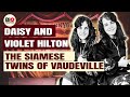 Daisy and Violet Hilton: The Siamese Twins of Vaudeville