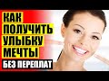 СТОИТ ЛИ ДЕЛАТЬ ВИНИРЫ