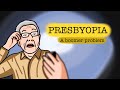 Presbyopia the expiry date given to your eyes