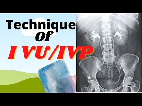 Technique of IVU/IVP (Ep-36) |Intravenous urogram/pyelogram |Procedure of  IVU/IVP test |