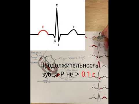Основы ЭКГ легко