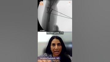 Fixed Angle Trajectories with K-Wire Placement