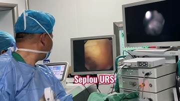 Guidewire Seplou single-use flexible ureteroscope-Zebar Guidewire