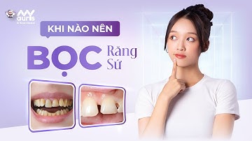 Khi nào nên bọc răng sứ