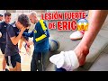 LESIÓN GRAVE de ERIC con el XBUYER TEAM *muy malas noticias…*