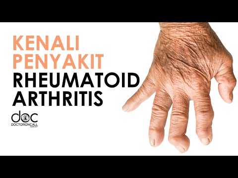 Kenali Penyakit Rheumatoid Arthritis. Apakah Gejala, Penyebab & Rawatannya?