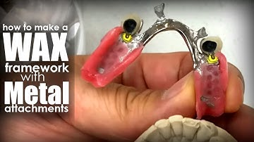 How to Make a Restoration with a Wax Framework and Metal Attachments | FULL PROCESS