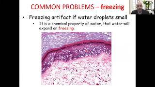(Histopathological techniques): Frozen technique in Histological preparations