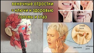 Зрение и слух зависят от зажатых венечных отростков челюсти. Методы декомпрессии