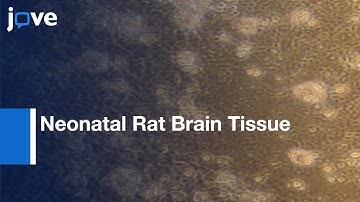 Primary Microglia Isolation-Mixed Glial Cell Cultures: Neonatal Rat Brain Tissue l Protocol Preview