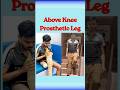 Above Knee Prosthetic Leg | Walk with Confidence Again #naklitang #artificialleg