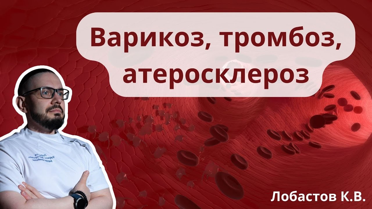 Доклад: "Варикоз, тромбоз, атеросклероз" (03.06.2023)
