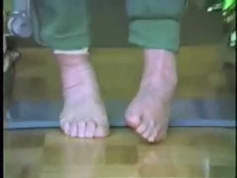 Remedial training of equinovarus foot due to stroke