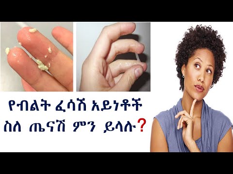 የብልት ፈሳሽ ስለ ጤናችን ምን ይነግረናል??? types of vaginal discharge and their meaning related to health