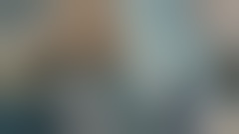 Animation and video of single chamber pacemaker-Right ventricular pacing