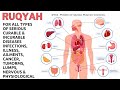 Ruqyah for all Types of Serious Curable&Incurable Diseases,Infections, Illness,Cancer,Tumorms&Lumps