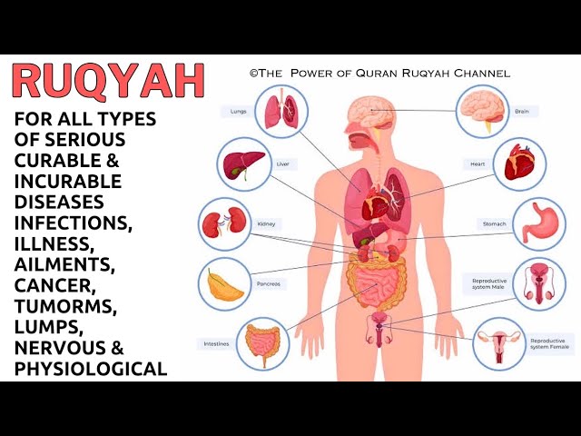 Ruqyah for all Types of Serious Curable&Incurable Diseases,Infections, Illness,Cancer,Tumorms&Lumps class=