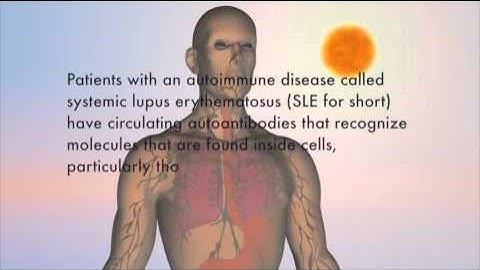 Dendritic Cell Movie CLATWORTHY LAB