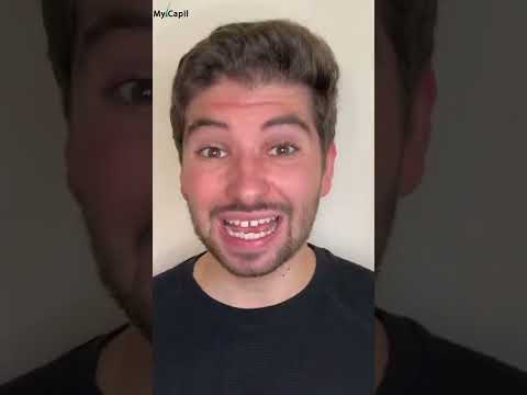 Minoxidil para el