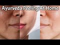 Ayurvedic तरीके से घर पर करे Chemical Peeling |Brightens Skin, Removes Pigmentation, Evens Skin Tone