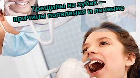 Трещины на зубах — причины появления и лечение