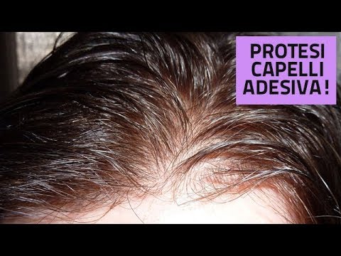 protesi capelli autoadesive