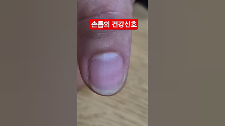 손톱으로 보는 건강신호! #건강 #손톱