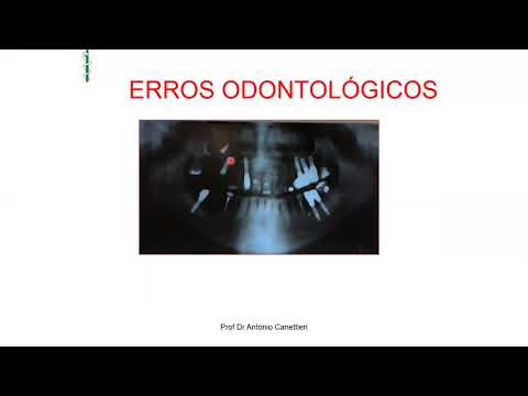 Vídeo: Tratamento Não Operatório De Lesão Hepática E Esplênica Contusa: Uma Análise De Tendência Temporal E De Resultados Ao Longo De Um Período De 17 Anos