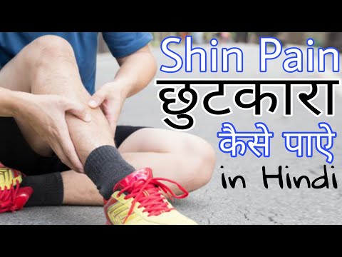 Shin pain सै छुटकारा कैसे पाऐ 100% Working Tips in hindi 1600 meter Running Tips