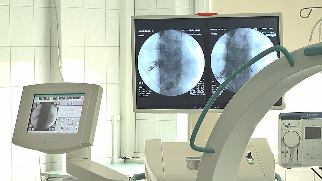 Ablacja, czyli leczenie migotania przedsionków