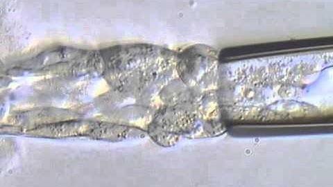 Trophectoderm biopsy