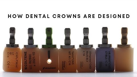 How Dental Crowns Are Designed Digitally X Dental Designs Clinic