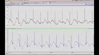 ZECG 02 - Zebrafish ECG Recording