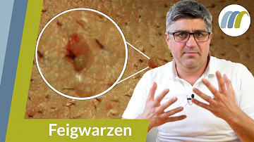 Was hilft am schnellsten gegen Feigwarzen?