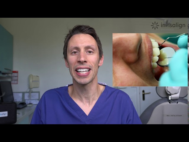 Jefferson Dental, Process of putting on Invisalign attachments!👏😁 Drop  all your Invisalign questions in comments!⤵️ #jeffersondental #invisalig
