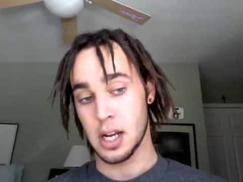 Do Dreads Make Your Hairline Recede | dreads day 3 youtube Do Dreads Make Your Hairline Recede | dreads day 3 youtube