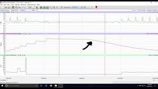 LabScribe - Blood Pressure Recording