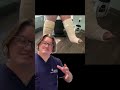 Lymphedema is challenging and no "Body" is the same.  There are solutions no matter how complex.