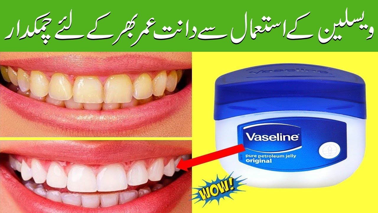 Takt Royal familie grøntsager How To Whiten Teeth With Vaseline In 2 Minutes || Teeth from Vaseline shine  for a lifetime - YouTube