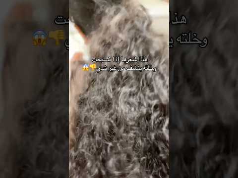 شعرك حلو بس العوامل الخارجيه تخربه وليف ان سوان يرجع لك حيويته والان مسوين عرض على العلبتين سوان