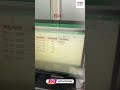 Find Expiry Date | Easy Formula to Calculate Expiry Dates Automatically | Softech Study #shorts