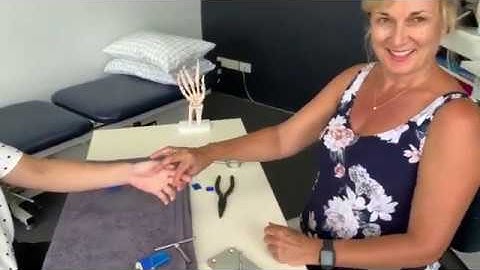 Capener Splint orthosis fabrication