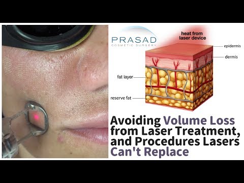 Avoiding Facial Volume Loss from Laser/ Radiofrequency Treatments, and Procedures They Can't Replace