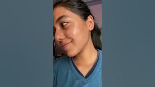 From Scars to Shine: My 6-Month Skincare Journey Glowing 🌟 #nandhitha #nandsskin