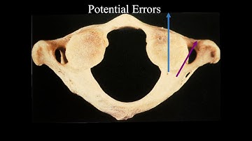 C1-2 Fixation Nuances - Praveen Mummaneni, MD
