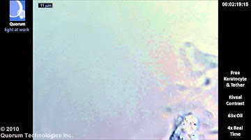 Riveal - Keratocyte Long Tether