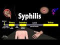 Syphilis  pathophysiology diagnosis and treatments animation